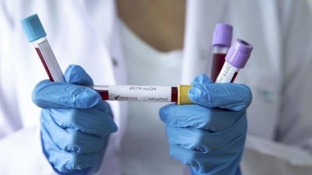 İl il corona virüs haritası yayımlandı 21