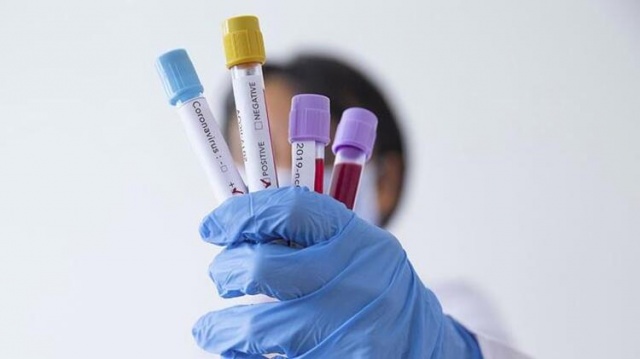 İl il corona virüs haritası yayımlandı 30