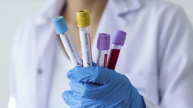 İl il corona virüs haritası yayımlandı 19