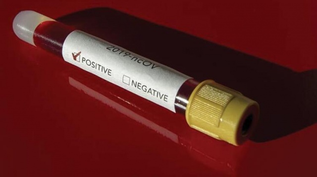 İl il corona virüs haritası yayımlandı 26