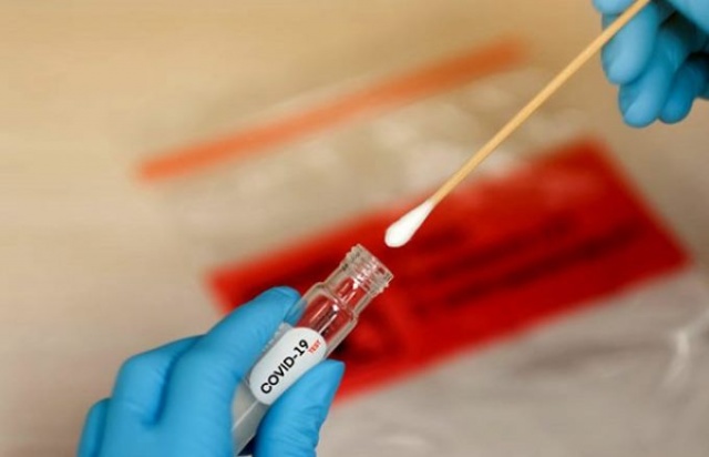 Koronavirüsün bir etkisi daha ortaya çıktı! 2