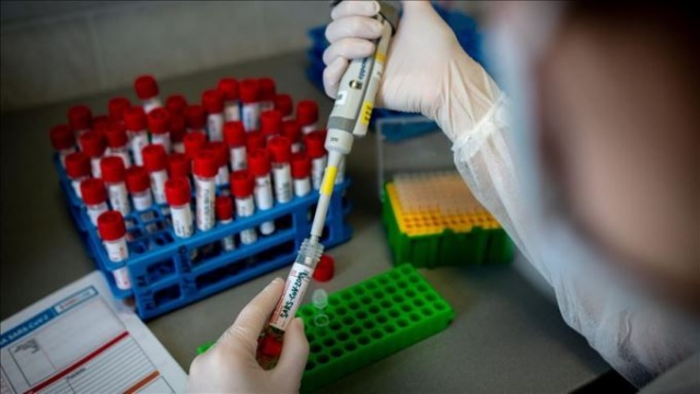 Dünya genelinde koronavirüsten ölenlerin sayısı 60 bini aştı 4