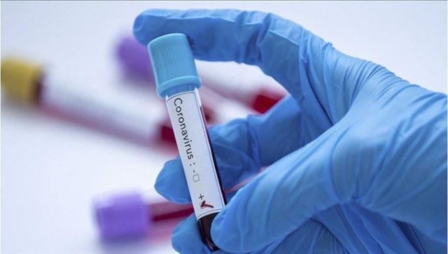 Türkiye vaka sayısında kaçıncı sırada? 4