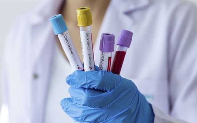 Koronavirüse karşı umutlandıran açıklama 7