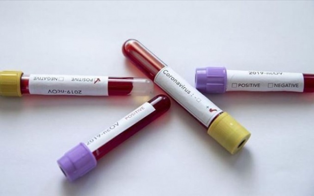 Koronavirüse karşı umutlandıran açıklama 8