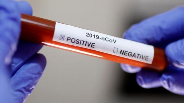 Bilim Kurulu üyesi tarih verdi 7