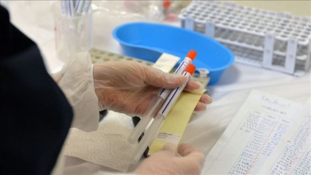 DSÖ Sözcüsü'nden Koronavirüs ilacı açıklaması  "Heyecan verici haberler var..." 4