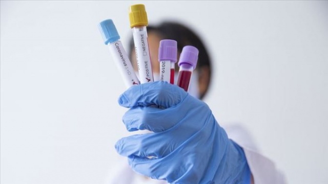 Virüsü izole eden profesörden dikkat çeken açıklama 16