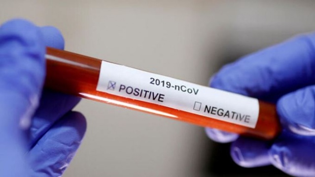 Koronavirüs mutasyona uğradı! Virüs bağışıklık sistemlerini yıkmak için sürekli mutasyona uğruyor. 3