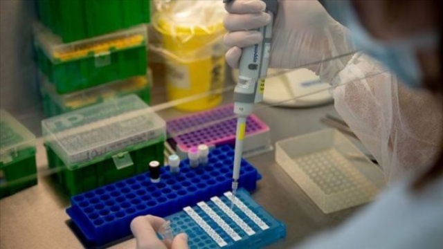 Koronavirüsün yeni belirtisi bulundu 11