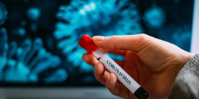 "Toplumun yüzde 60'ı yakalanana kadar koronavirüs yayılır" 12