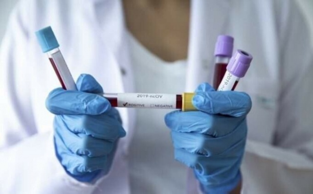 Koronavirüs aşısında flaş gelişme! Denemeye başladılar 4