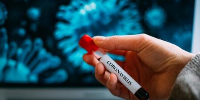 Koronavirüs kargoyla bulaşır mı? 2