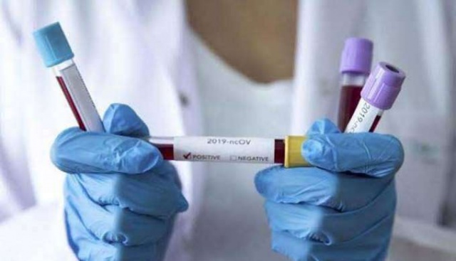 Koronavirüs kargoyla bulaşır mı? 4