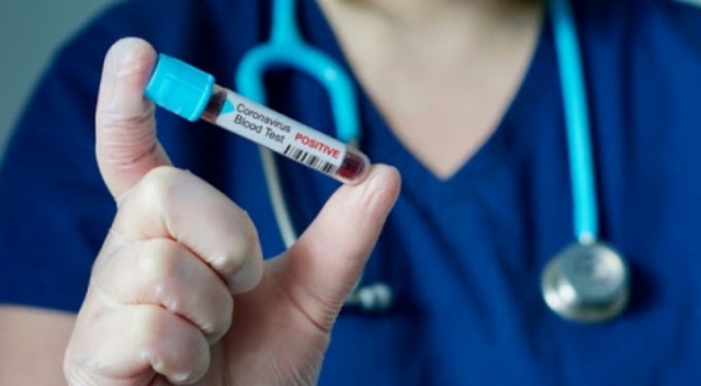 Koronavirüs kargoyla bulaşır mı? 5