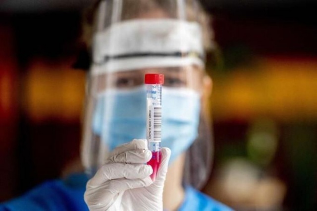 Koronavirüsün ilacı bulundu, DSÖ açıklama yaptı 7