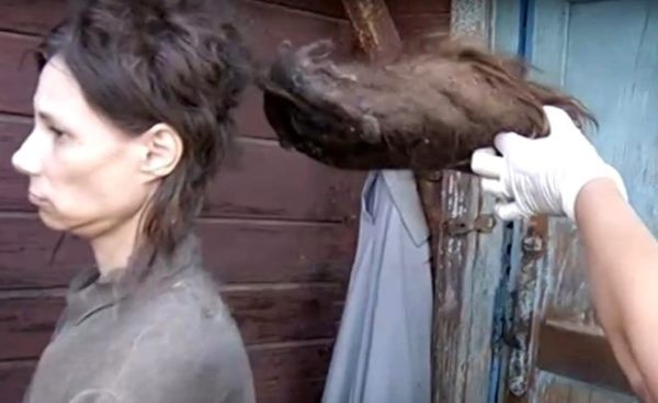 Kızını 26 yıldır kedi mamasıyla besliyor, 14 yıldır banyo yaptırmıyor 10