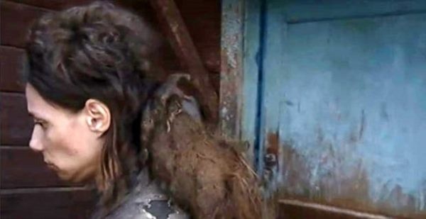 Kızını 26 yıldır kedi mamasıyla besliyor, 14 yıldır banyo yaptırmıyor 4