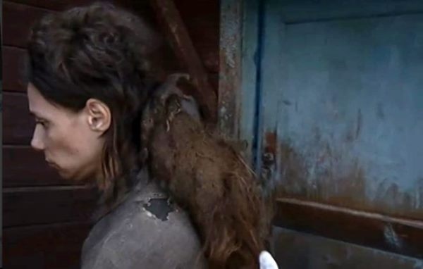 Kızını 26 yıldır kedi mamasıyla besliyor, 14 yıldır banyo yaptırmıyor 7