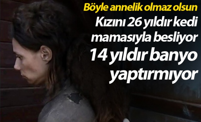 Kızını 26 yıldır kedi mamasıyla besliyor, 14 yıldır banyo yaptırmıyor 1