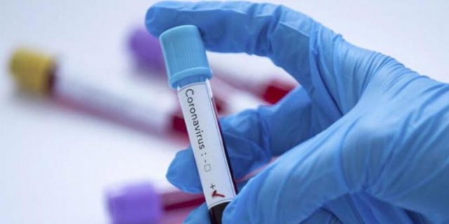 Koronavirüs aşısına iki hafta kaldı! 12