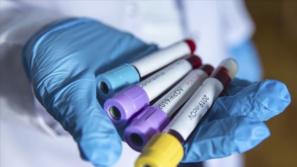 Trabzon’da koronavirüs vaka sayısı korkutuyor 6