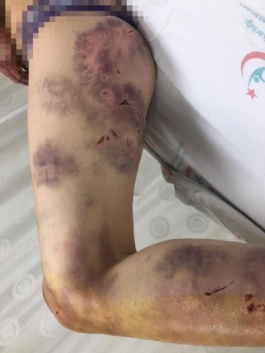 Dini nikahlı eşine dehşeti yaşattı 4