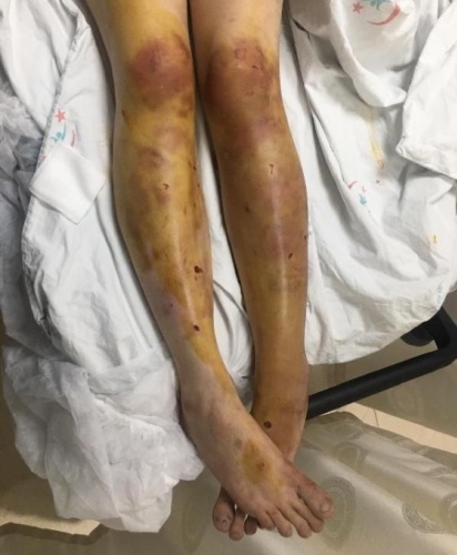 Dini nikahlı eşine dehşeti yaşattı 6