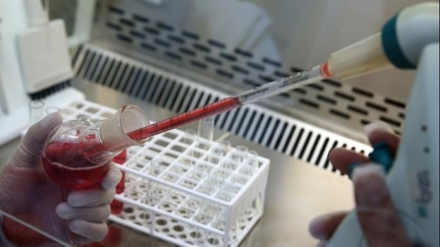 Koronavirüse karşı en şanslı kan grubu hangisi? 8