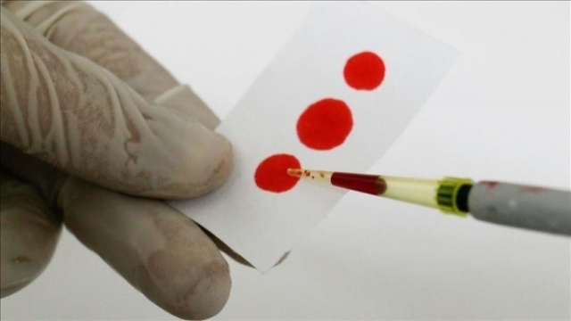 Kim ne zaman aşılanacak? 5