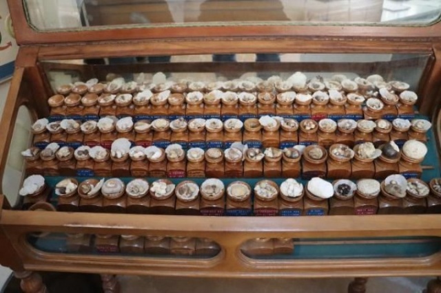 İnanılmaz koleksiyon! Hastalarından çıkardıklarını saklıyor 13