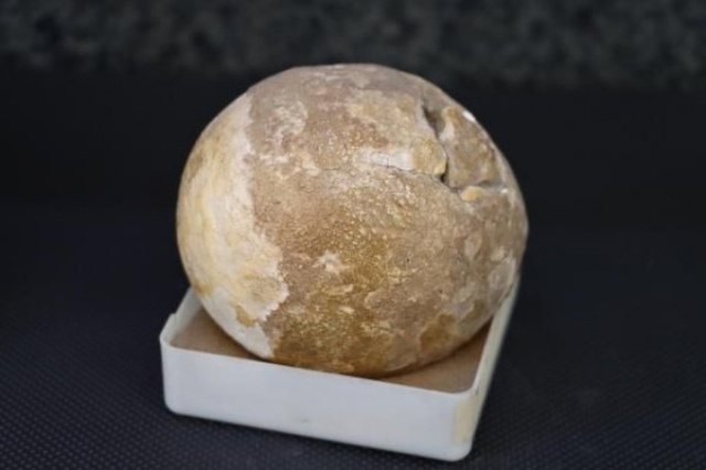 İnanılmaz koleksiyon! Hastalarından çıkardıklarını saklıyor 9