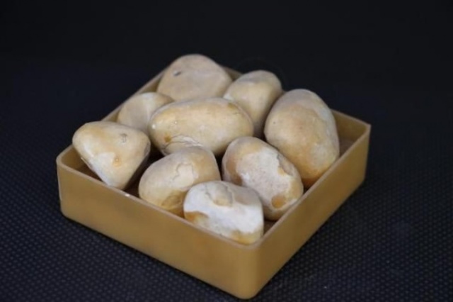 İnanılmaz koleksiyon! Hastalarından çıkardıklarını saklıyor 2