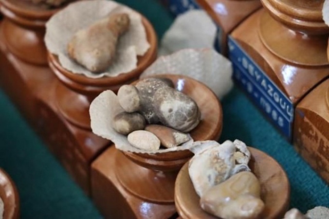 İnanılmaz koleksiyon! Hastalarından çıkardıklarını saklıyor 5