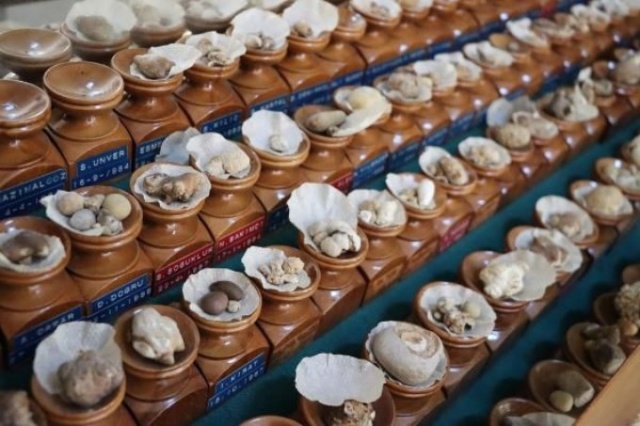 İnanılmaz koleksiyon! Hastalarından çıkardıklarını saklıyor 7