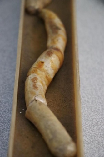 İnanılmaz koleksiyon! Hastalarından çıkardıklarını saklıyor 8