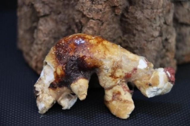 İnanılmaz koleksiyon! Hastalarından çıkardıklarını saklıyor 12