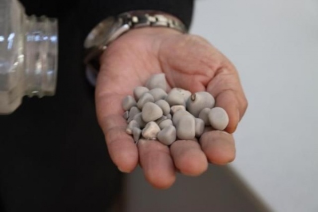 İnanılmaz koleksiyon! Hastalarından çıkardıklarını saklıyor 10