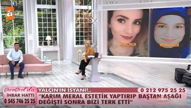 Önce estetik yaptırdı sonra kocasını terk etti! 6