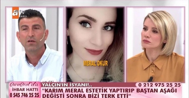 Önce estetik yaptırdı sonra kocasını terk etti! 11