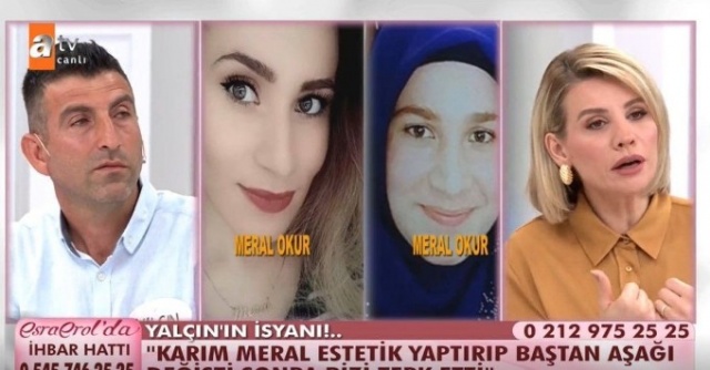 Önce estetik yaptırdı sonra kocasını terk etti! 4