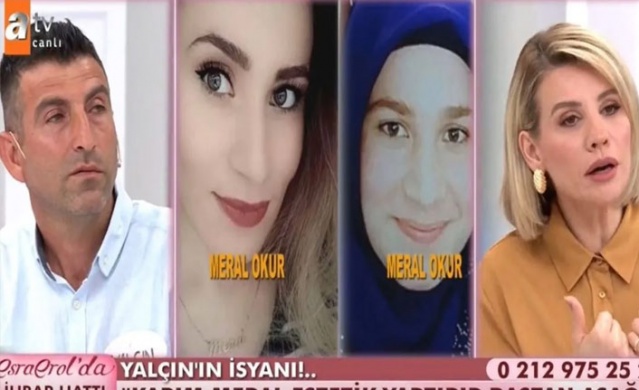 Önce estetik yaptırdı sonra kocasını terk etti! 1