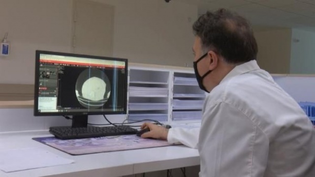 Koronavirüsün bu belirtisi ilk kez ortaya çıktı 3