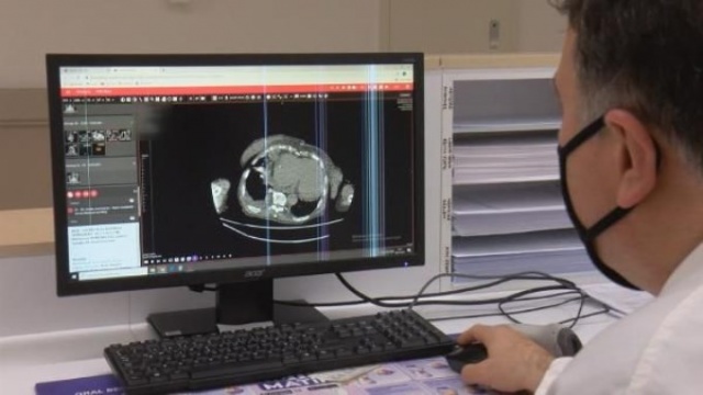 Koronavirüsün bu belirtisi ilk kez ortaya çıktı 8