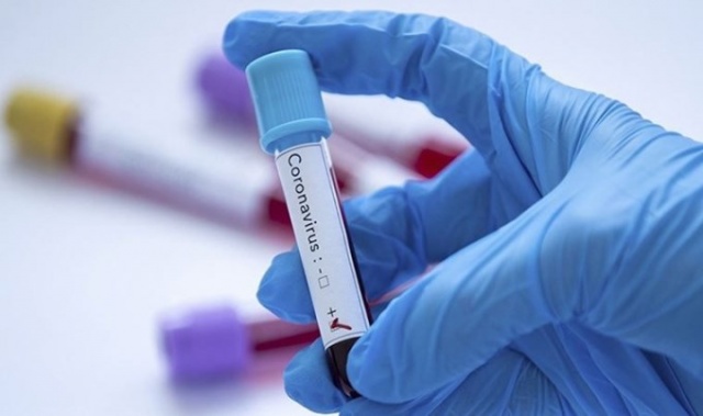 Koronavirüsün bu belirtisi ilk kez ortaya çıktı 9