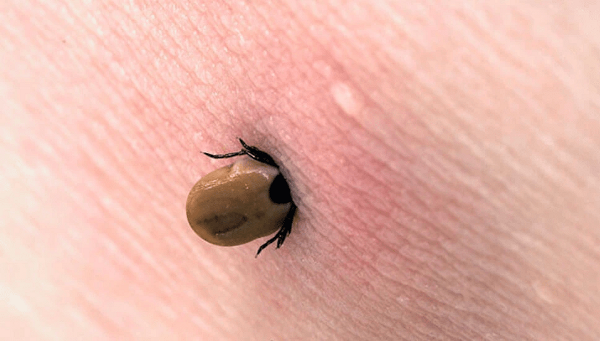 Yaz aylarının korkulu rüyası! Keneler hakkında doğru bilinen yanlışlar. Foto Haber 13