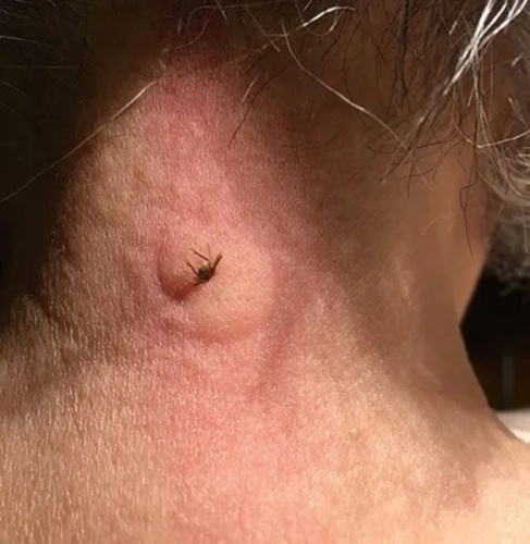 Yaz aylarının korkulu rüyası! Keneler hakkında doğru bilinen yanlışlar. Foto Haber 11