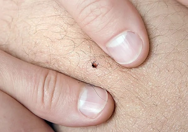 Yaz aylarının korkulu rüyası! Keneler hakkında doğru bilinen yanlışlar. Foto Haber 14