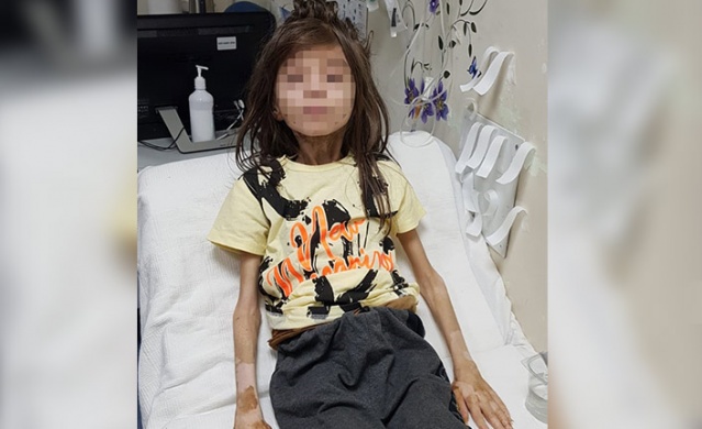 Boşaltılmak istenen çöp evde 1 yıldır odaya kilitli çocuk baygın bulundu. Foto Galeri 3