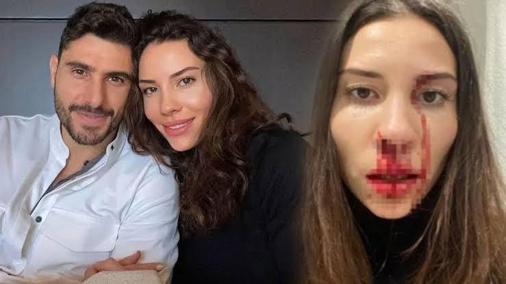 Özer Hurmacı ile eşinin darp davasında karar çıktı! İşte verilen ceza! - Foto Haber 11